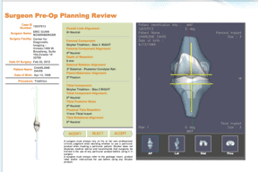 Figure 1: Screen grab of ShapeMatch pre-op surgical plan. Both MRi and CT (Computed Tomography) scans can be used for these protocols.