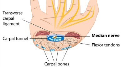 carpal-tunnel-featured