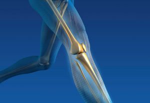 Femoral Nerve Blocks