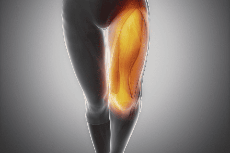 3d model of the quadriceps tendon