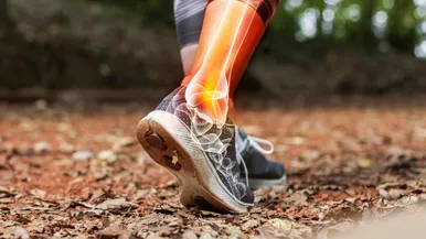 High ankle sprain showing syndesmotic injury with pain highlighted above the ankle joint